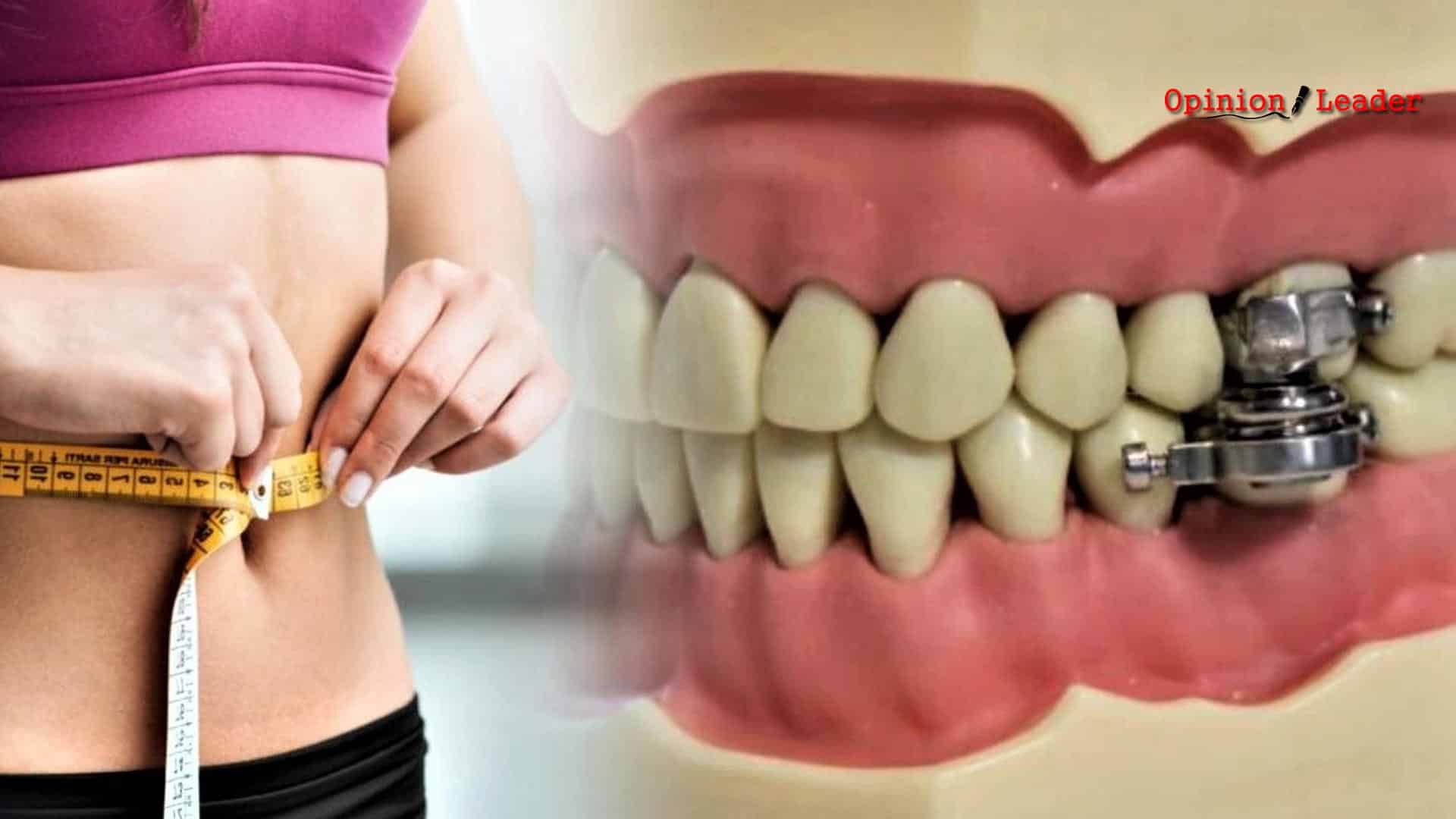 κλειδαριά στόμα - παχυσαρκία